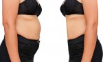 woman-weight-loss-before-after-1.jpg